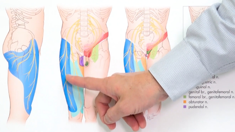 "Diagram showing the pathways of nerves in the pelvic and thigh area, with the lateral femoral cutaneous nerve highlighted in relation to meralgia paresthetica