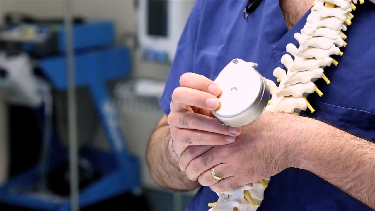 Healthcare professional holding an Intrathecal Pain Pump next to a spinal model