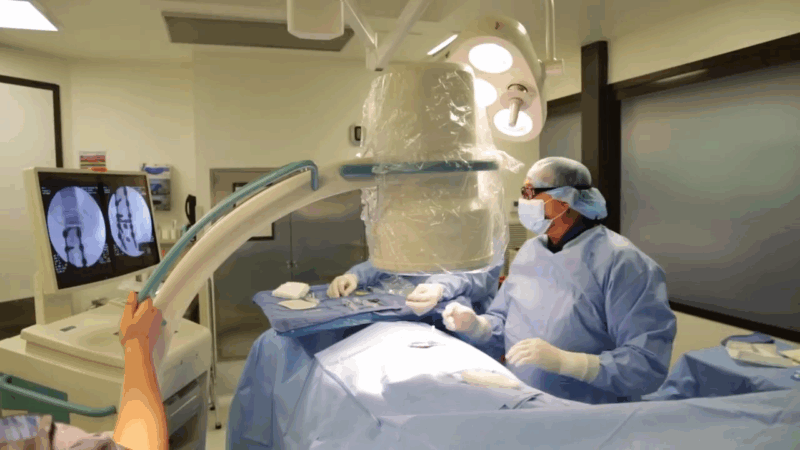 Surgical team performing an intrathecal pain pump trial