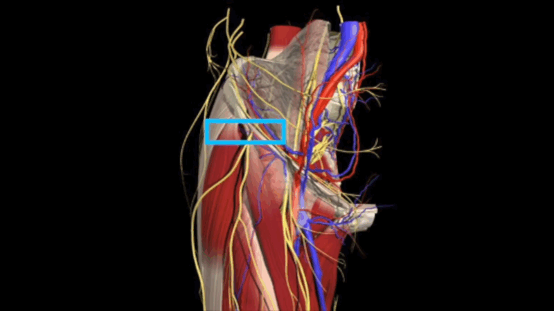 An anatomical diagram highlighting the nerves in the pelvic and thigh region, with emphasis on the lateral femoral cutaneous nerve