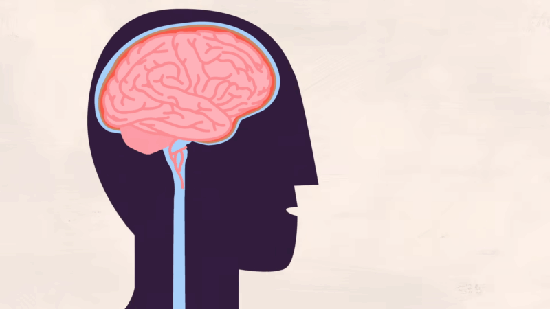 The image illustrates a simplified diagram of the brain and cerebrospinal fluid pathway