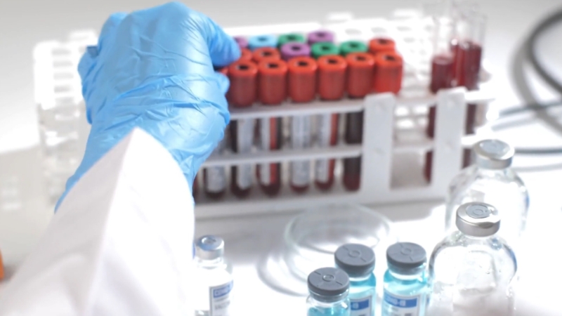 A lab worker organizes blood samples used to identify key causes of low iron saturation with normal ferritin