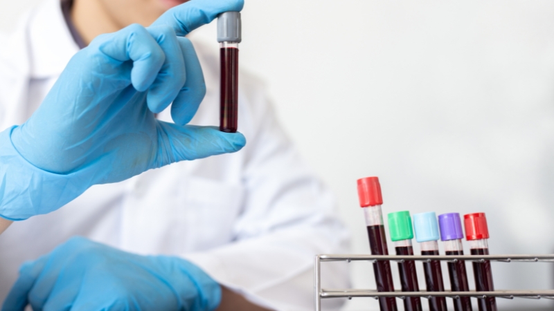 A lab technician holds a blood sample for analysis to investigate causes of low iron saturation with normal ferritin